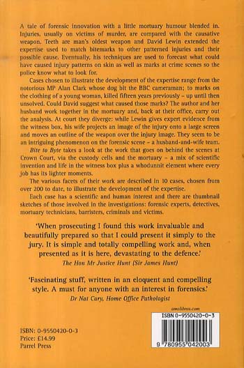 Bite to Byte: The Story of Injury Analysis (Paperback)